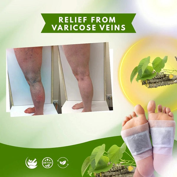 🌿 Ginger Detox Foot Patch Deep Cleansing & Wellness Support – Buy 1 Get 1 FREE |